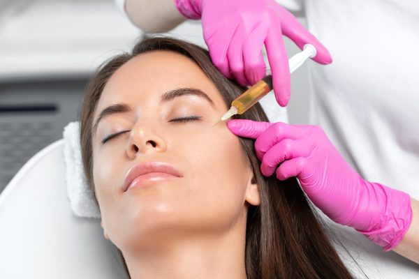 PRP Face Treatment